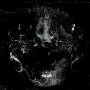Nibiru - Anamorphosis (Ltd. CD)