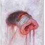 American Heritage - Prolapse