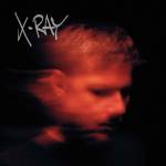 Murdock - X-Ray (2LP)