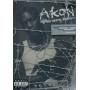 Akon - His Story [Regio free (0)] [US-Version]